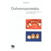 GALWANOPROTETYKA