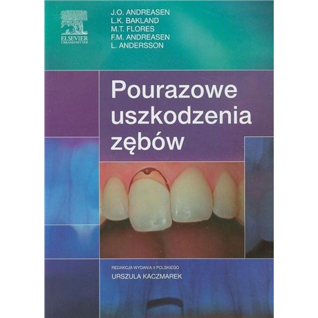 POURAZOWE USZKODZENIA ZĘBÓW-2890