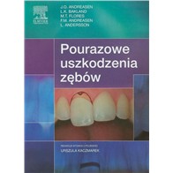 POURAZOWE USZKODZENIA ZĘBÓW