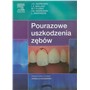 POURAZOWE USZKODZENIA ZĘBÓW-2890