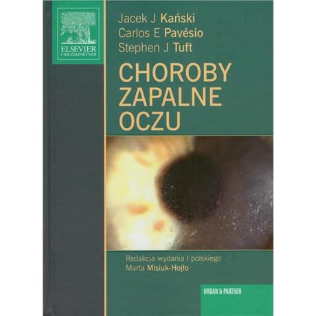 CHOROBY ZAPALNE OCZU-3007