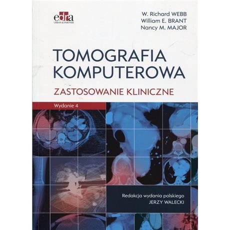 TOMOGRAFIA KOMPUTEROWA ZASTOSOWANIE KLINICZNE-3993
