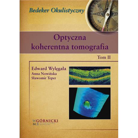 OPTYCZNA KOHERENTNA TOMOGRAFIA 2-1317