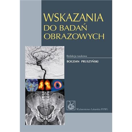 WSKAZANIA DO BADAŃ OBRAZOWYCH PRUSZYŃSKI-3517