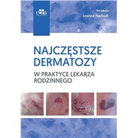 NAJCZĘSTSZE DERMATOZY