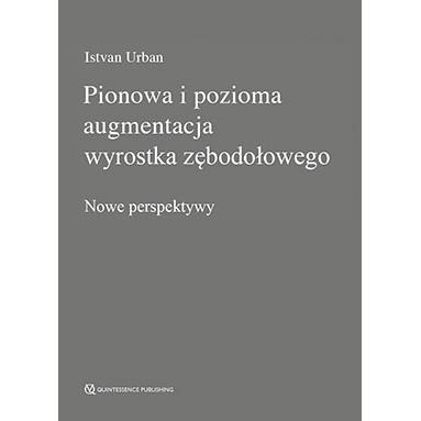 PIONOWA I POZIOMA AUGMENTACJA WYROSTKA ZĘBODOŁOWGO-4709