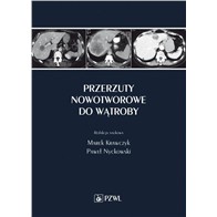 PRZERZUTY NOWOTWOROWE DO WĄTROBY
