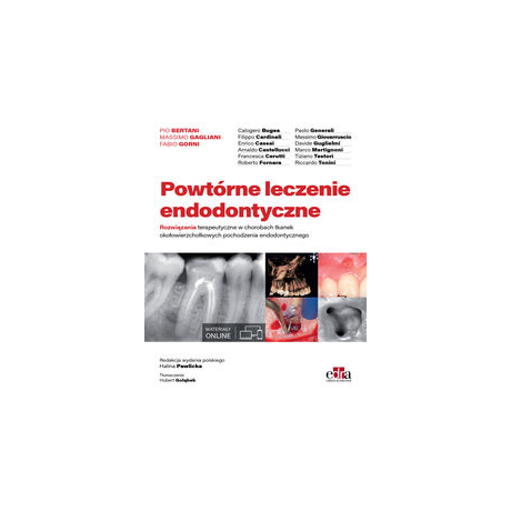 POWTÓRNE LECZENIE ENDODONTYCZNE