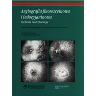 ANGIOGRAFIA FLUOROSCENCYJNA