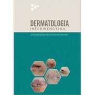 DERMATOLOGIA INTERWENCYJNA