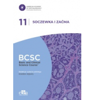 BCSC SOCZEWKA I ZAĆMA 11