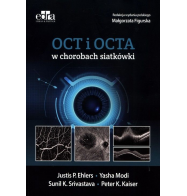 OCT i OCTA W CHOROBACH SIATKÓWKI