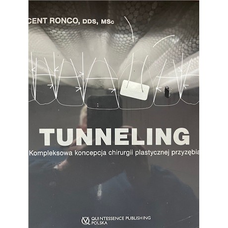 TUNNELING KOMPLEKSOWA KONCEPCJA CH PLASTYCZ PRZYZĘ-5326