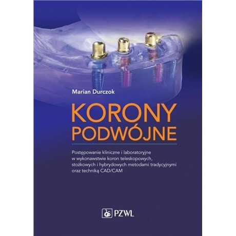 KORONY PODWÓJNE POSTEPOWANIE KLINICZNE-5332