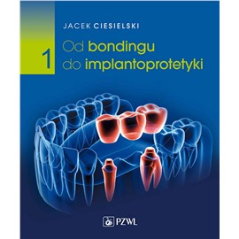 OD BONDINGU DO IMPLANTOPROTETYKI